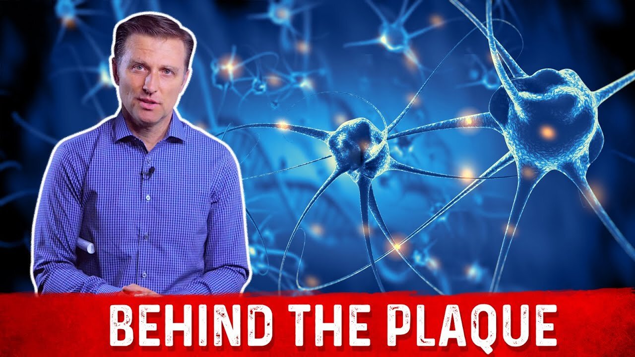 What is Plaque and How to Remove it Explained By Dr.Berg