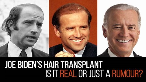 Joe Biden's Hair From 1979 to 2024 The Greatest Comeback Story In History! LOL