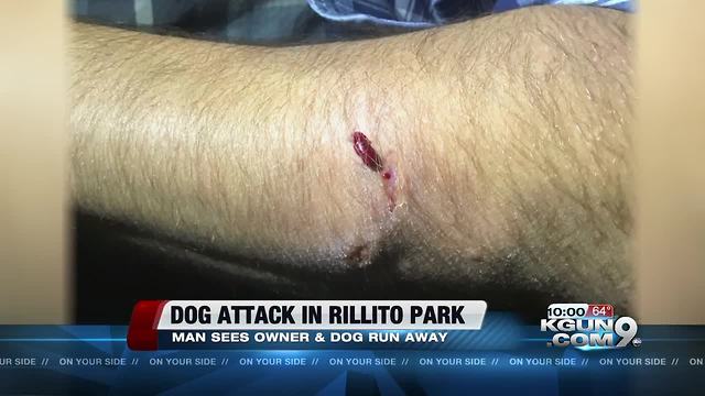 Dog bites man at Rillito River Park; victim asks for help to find dog's owner