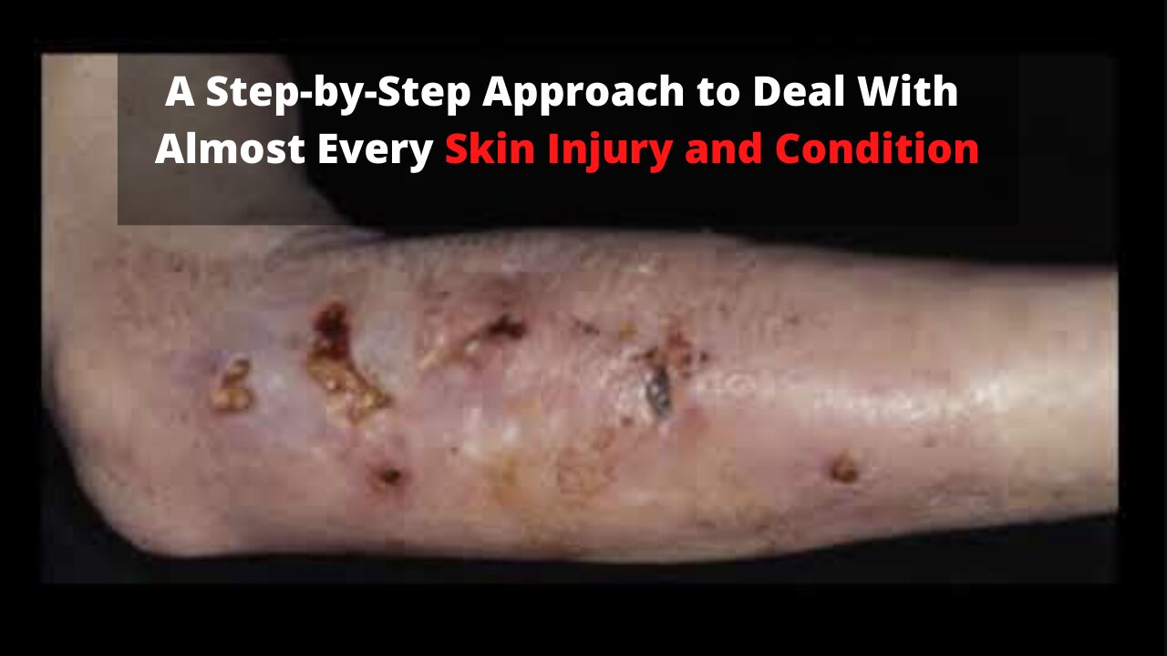 A Step-by-Step Approach to Deal With Almost Every Skin Injury and Condition