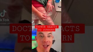 Doctor reacts to gnarly sunburn!!!