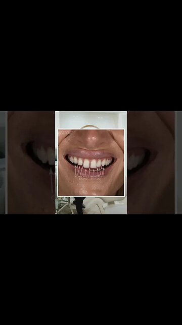 Dental And Teeth Hygiene