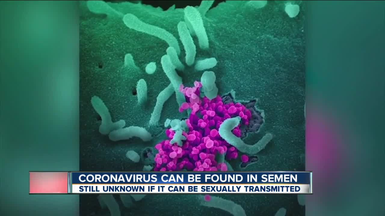 COVID-19 found in semen but unknown if transmitted sexually