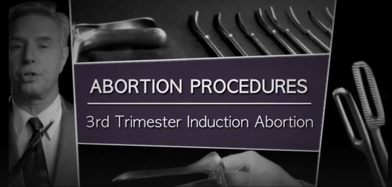 3rd Trimester Abortion Exposed - KILLED by LETHAL Injection