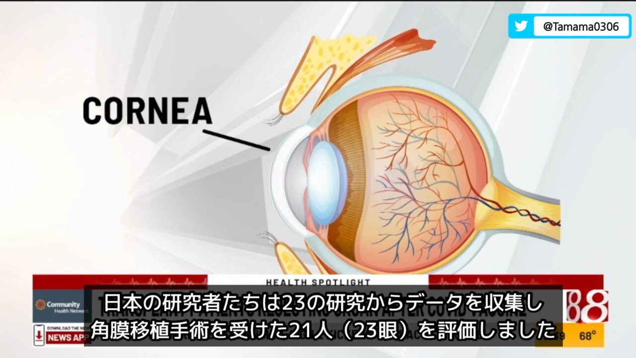 日本の研究、角膜移植者が全員コロワク接種後に拒絶反応を起こした
