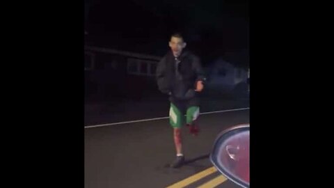 Guy Hoping Down The Street With One Leg Cut Off (WTF)