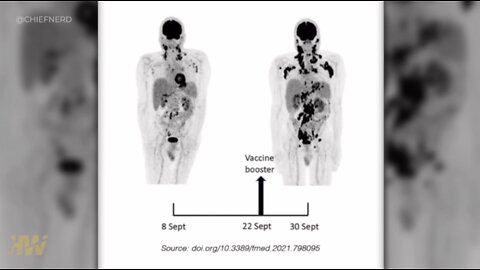 "Did a Famous Doctor's COVID Shot Make His Cancer Worse?": The Highwire Shares the Details