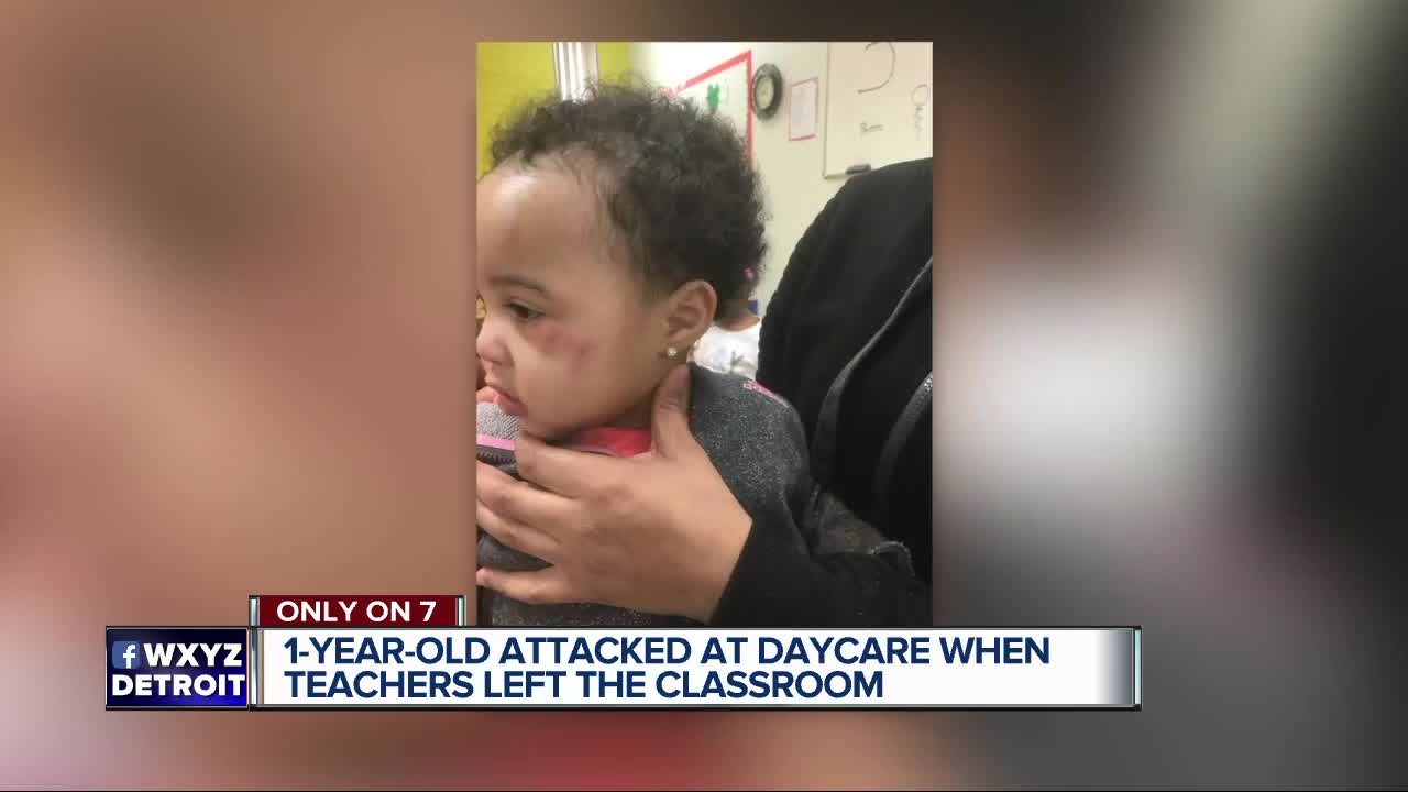 Daycare owner responds after child attacked when adults in charged left room