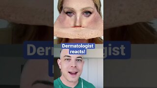 Derm reacts!