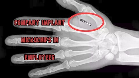 Tech Company Implant Microchips In Employees