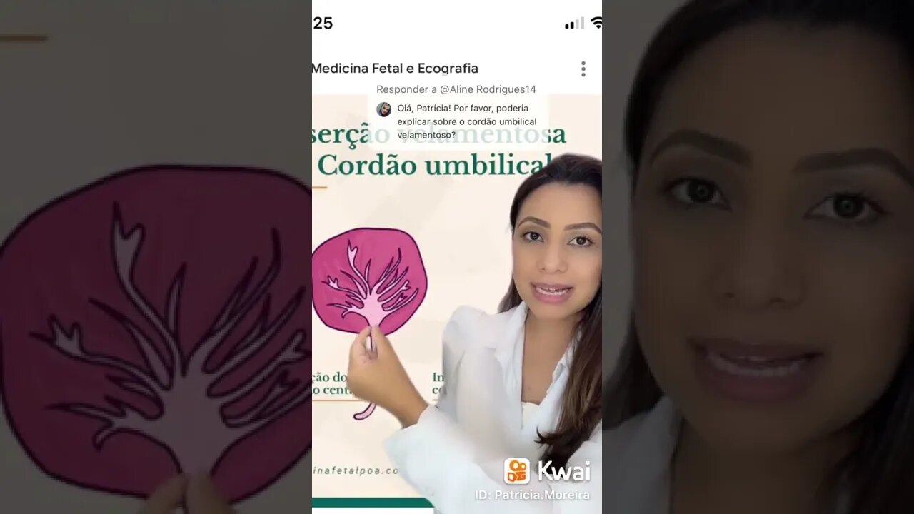 Cordão umbilical velamentoso