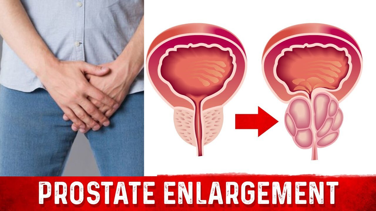 how to cure an enlarged prostate and prostate cancer and keep your prostate healthy