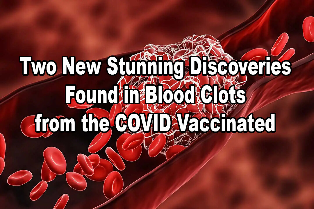 Two New Stunning Discoveries Found in Blood Clots from the COVID Vaccinated - Dr. Jane Ruby