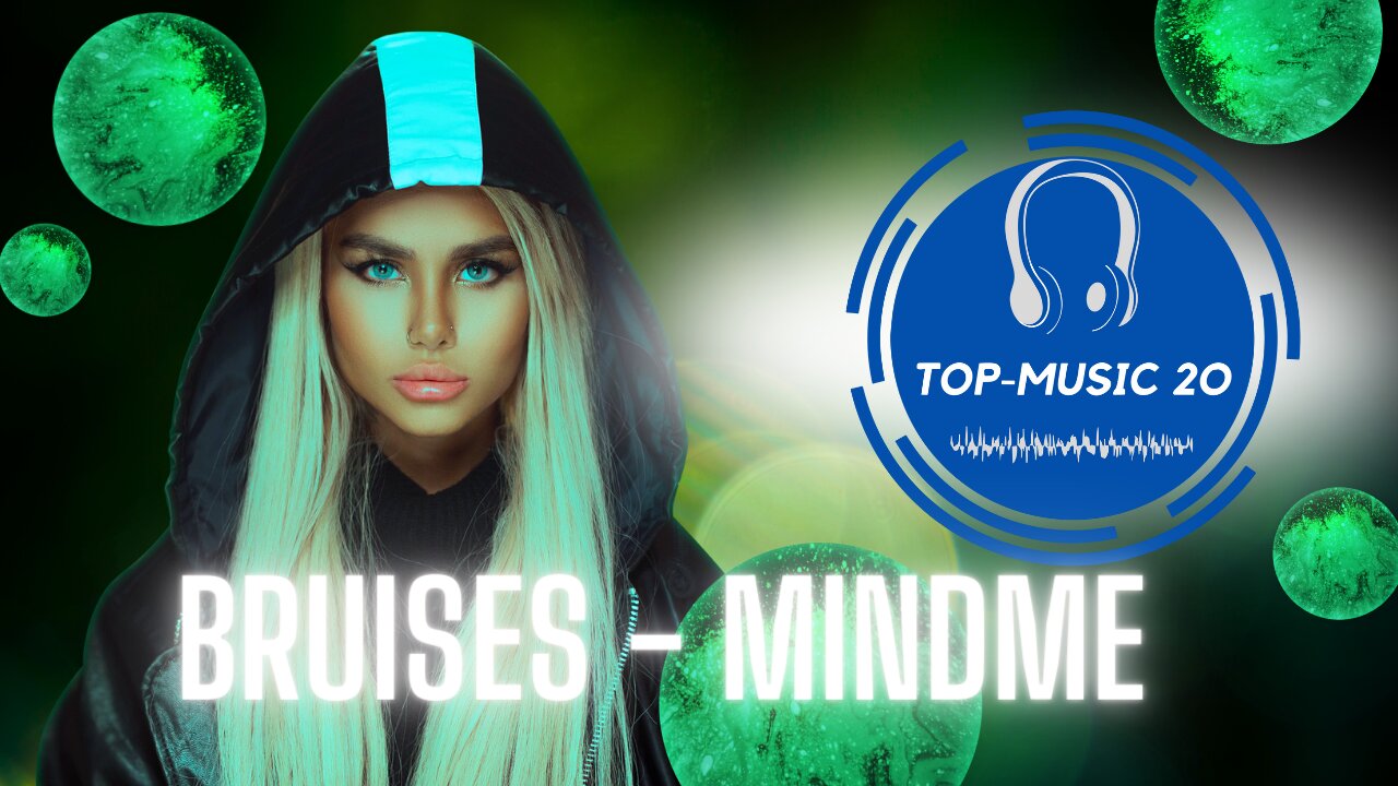Top-Music 20 - Bruises - Mindme