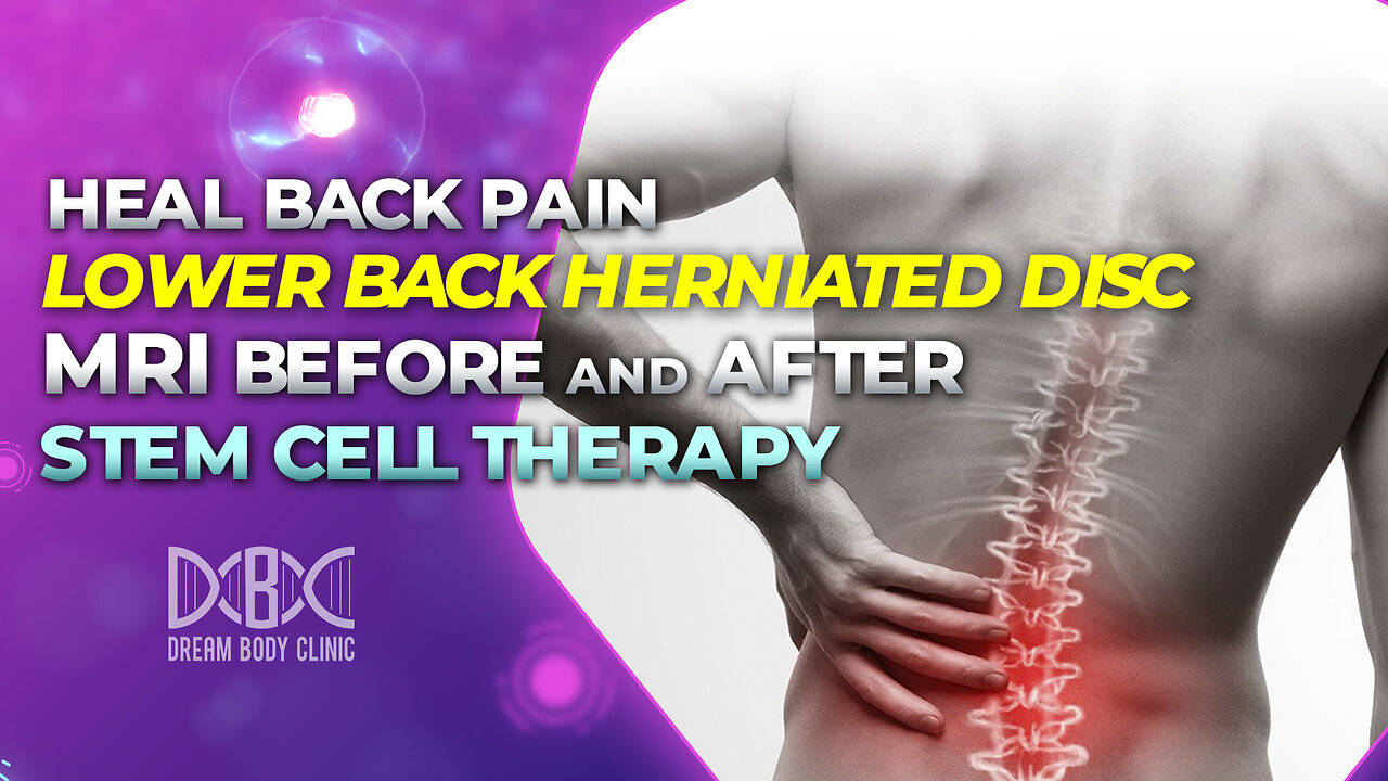 Heal Back Pain. Lower Back Herniated Disc MRI Before and After Stem Cell Therapy at DBC