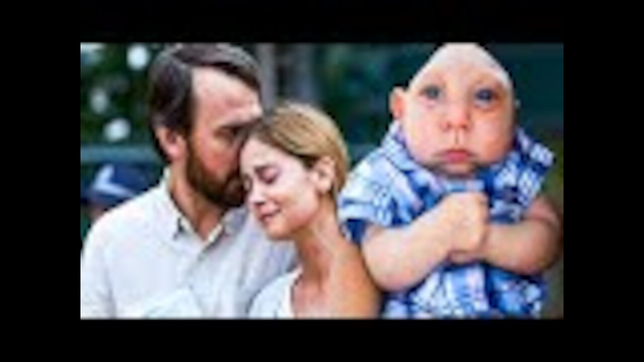 Boy Born Without A Brain, 6 Years Later Look At What Doctors Find Inside