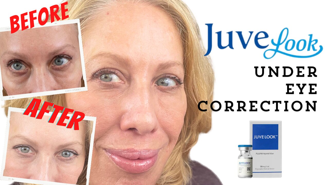 Juvelook - Undereye Correction