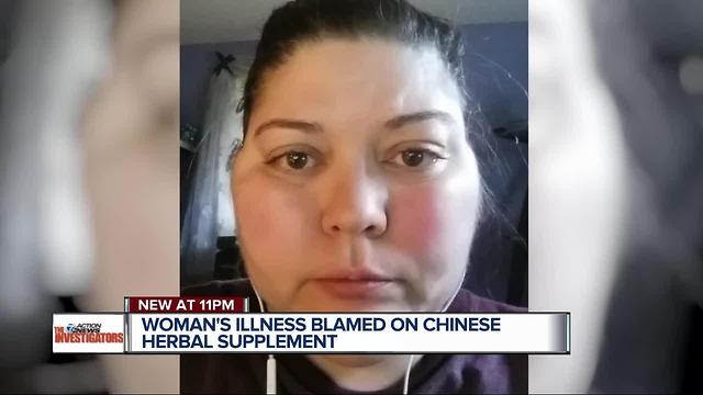 Madison Heights woman: Herbal supplement caused life-threatening illness