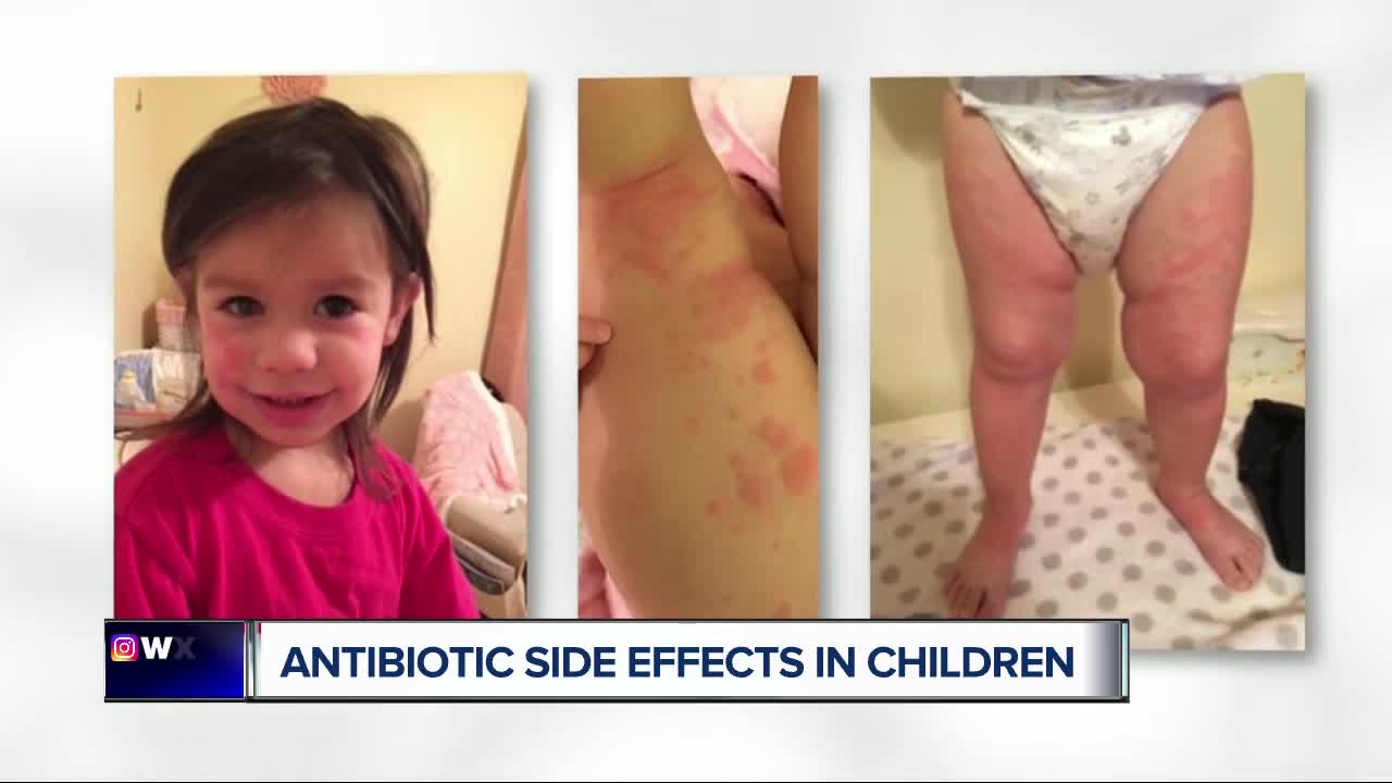 Antibiotic side effects send tens of thousands of kids to the ER every year