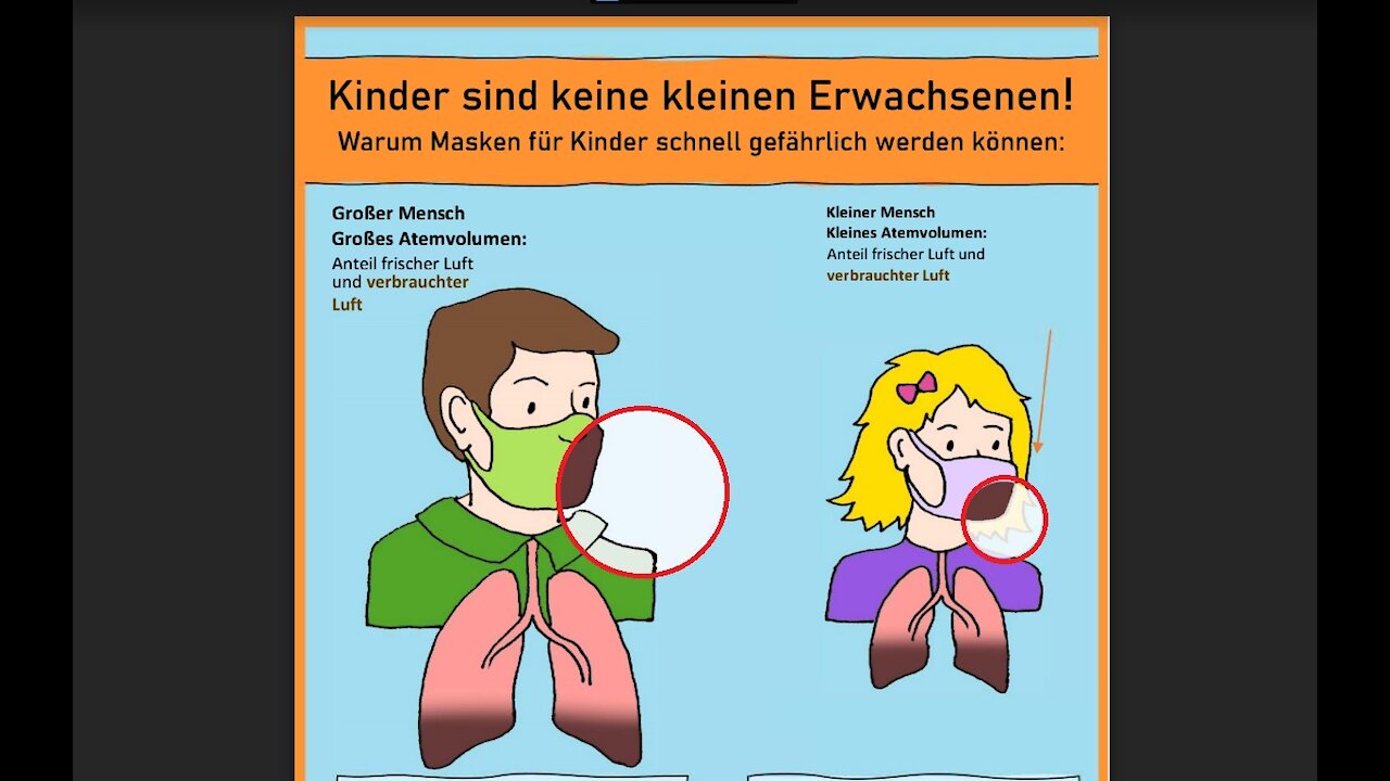 Risiken & Langzeitfolgen / MNS-Kinder Masken-Totraum