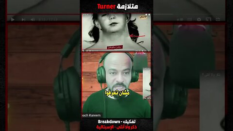 متلازمة تيرنور