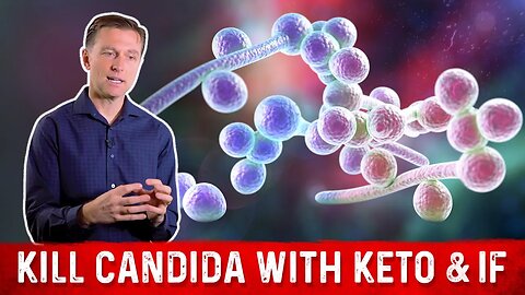 Kill Candida with Keto & Intermittent Fasting – Dr. Berg on Candida Infection