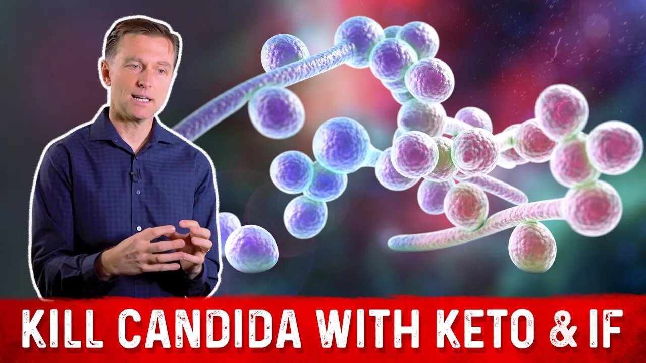 Kill Candida with Keto & Intermittent Fasting – Dr. Berg on Candida Infection