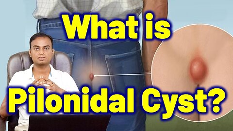 What is Pilonidal Cyst? | Treatment Cure Medicine Surgery | Pilonidal Cyst Sinus Abscesses