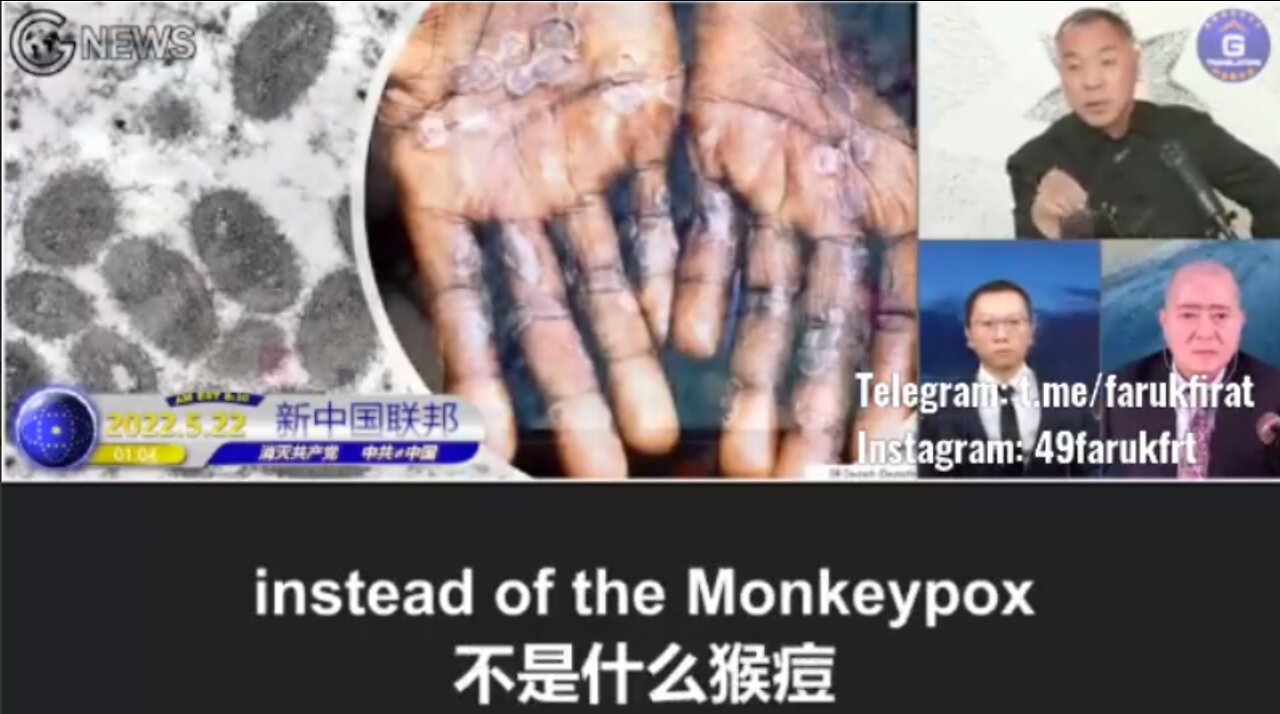 Chinese whistleblower Miles Guo: "MonkeyPox is just an excuse for disaster caused by COVID jabs"