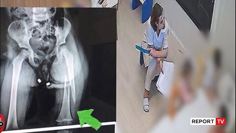 Dhunimi i 3-vjeçares në kopsht, zv.ministrja e Arsimit: ‘Stinët’ s’kishte licencë nga MAS!