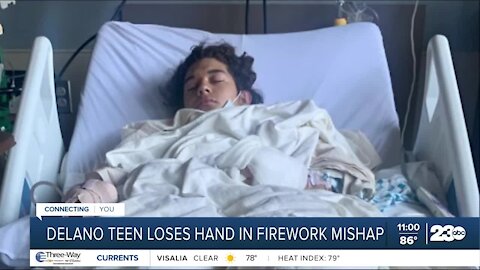 Delano teenager loses hand in fireworks incident