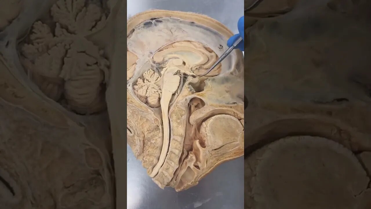 REAL Human Pituitary Gland