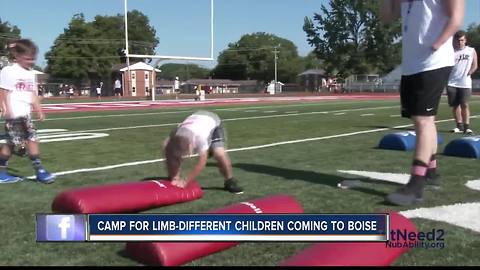 Camp for limb-different children visiting Boise