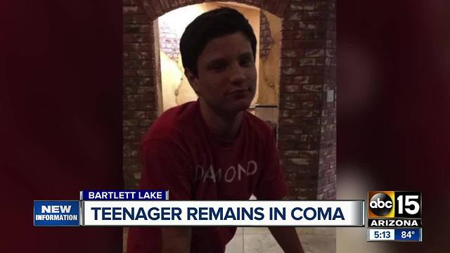 Teenager remains in coma after boating accident on Bartlett Lake