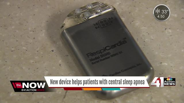 New FDA-approved device tested at Saint Luke's helps patients with central sleep apnea