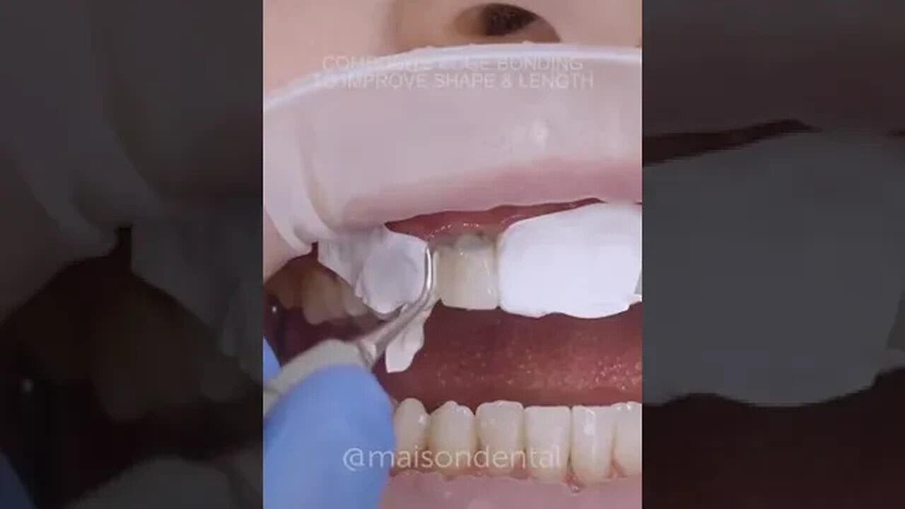 Dental And Teeth Hygiene