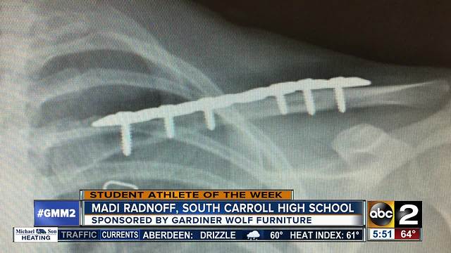 Student athlete Madi Radnoff South Carroll High School