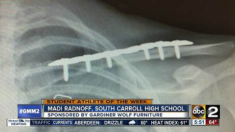 Student athlete Madi Radnoff South Carroll High School