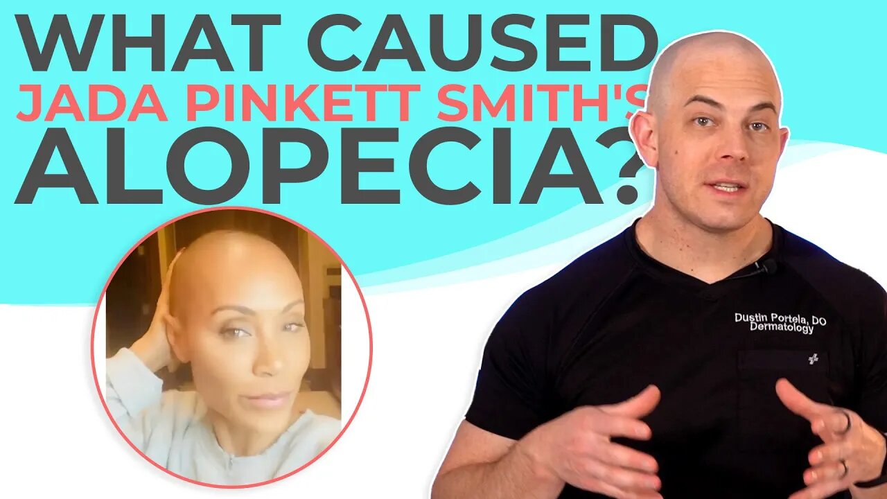 What Does Alopecia Mean? | 208SkinDoc