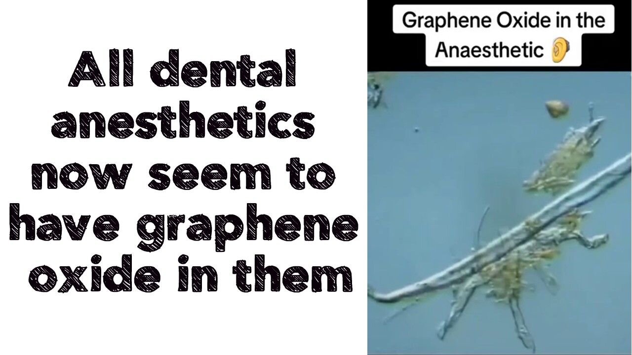 All dental anesthetics now seem to have graphene oxide in them