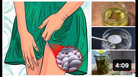Top 8 Home Remedies for Yeast Infection (Candidiasis)