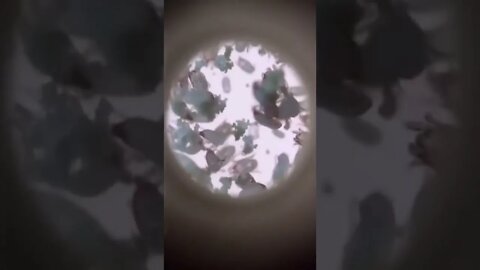 Microscope for phone