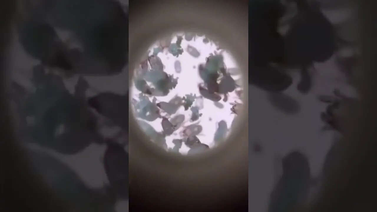 Microscope for phone