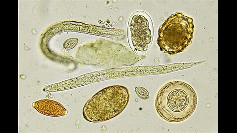 ARE PARASITES 🦠 DEMONIC IN HIGHER DIMENSIONAL PHYSICS ?