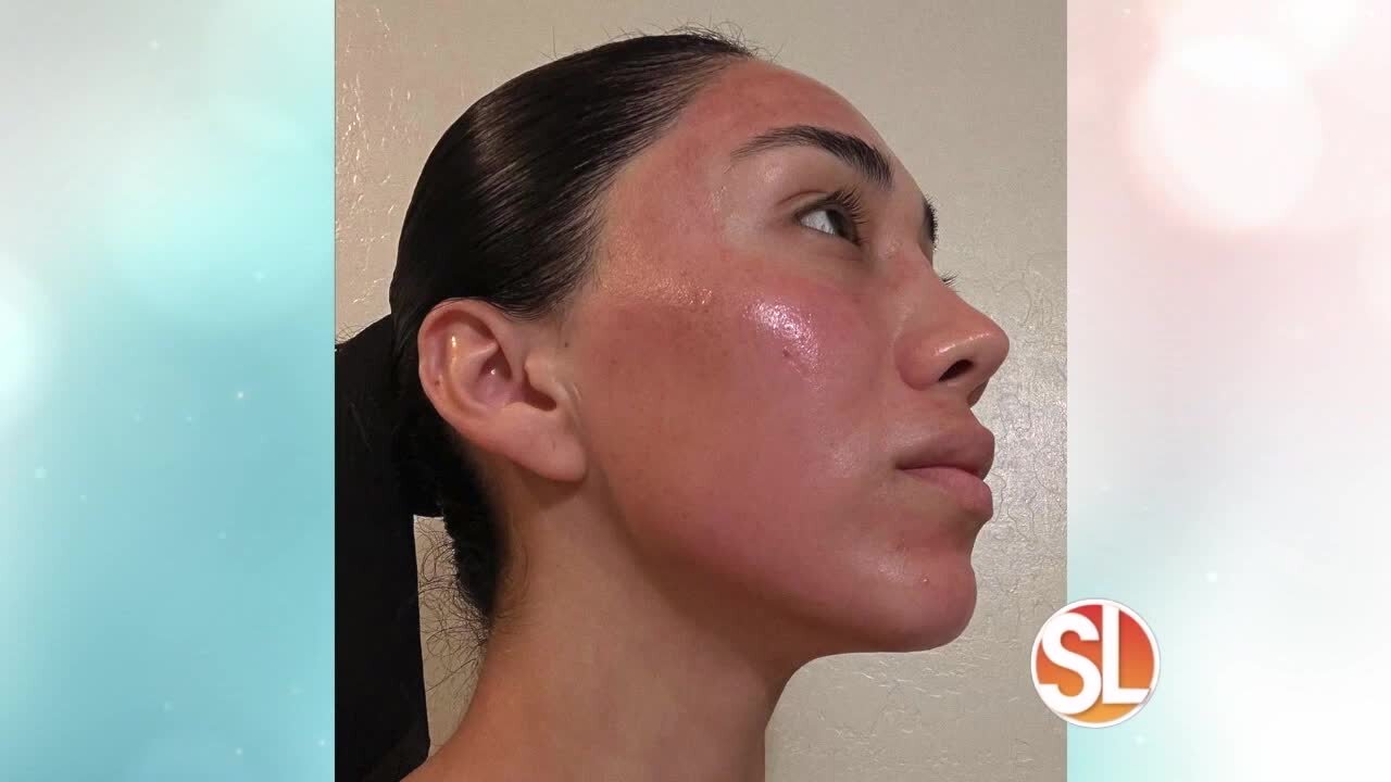 UGlow Face & Body offers a non-surgical facelift
