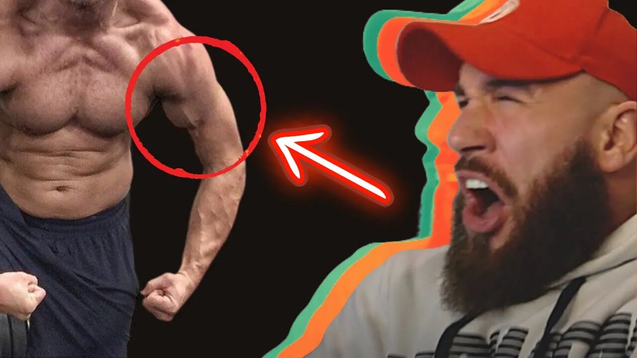 BODYBUILDER REACTS TO BICEP TEARS