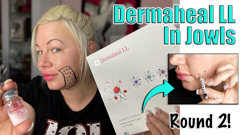 Dissolving Jowls with Dermaheal LL: Round 2 from Acecosm.com | Code Jessica10 Saves you Money!