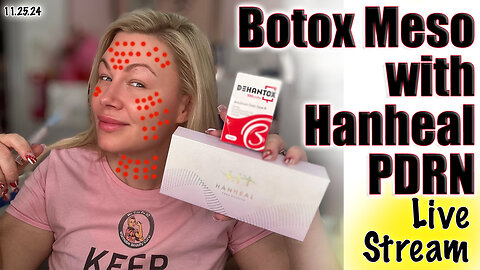 Live Botox Meso with Hanheal PDRN, Acecosm.com | Code Jessica10 Saves you Money