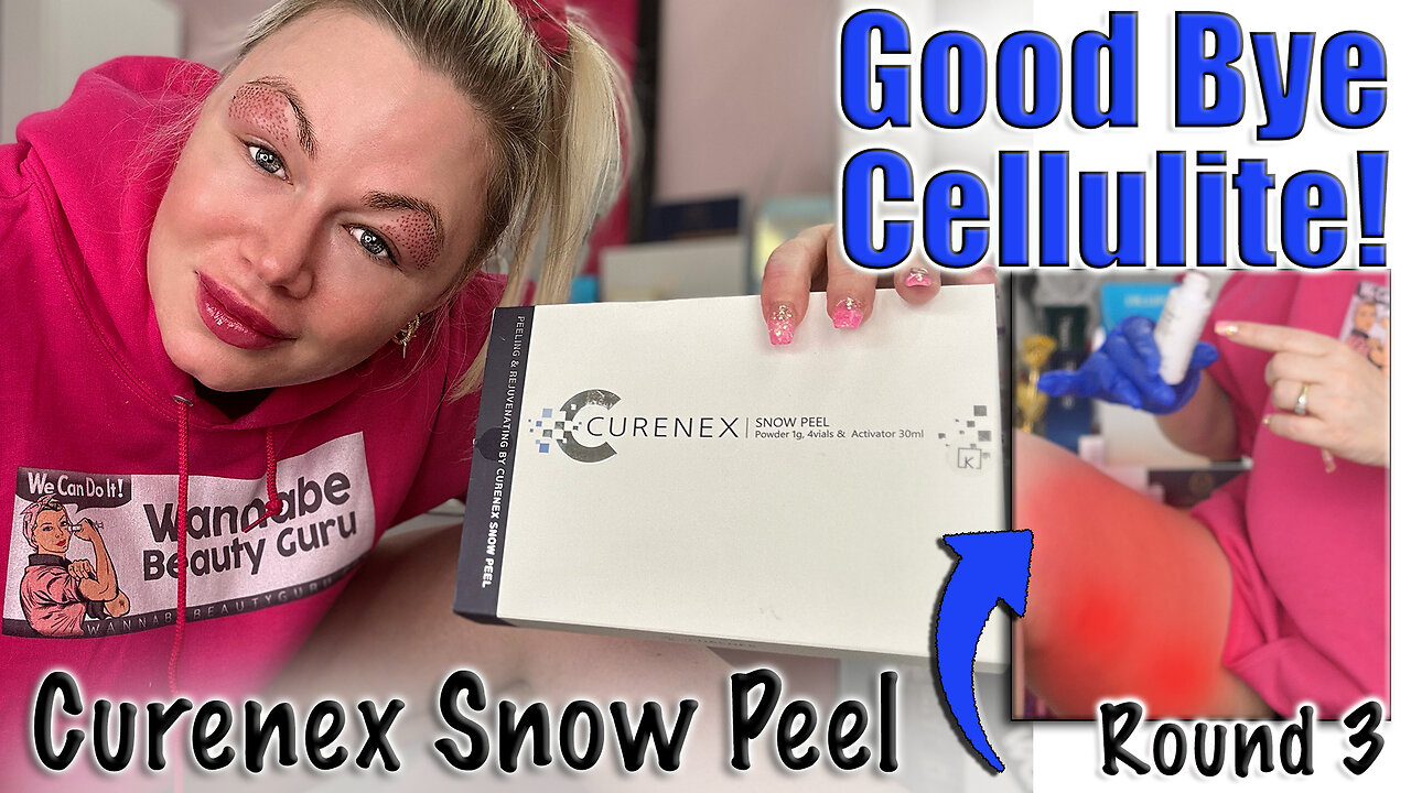 Good Bye Cellulite, Curenex Snow Peel on Thighs, Round 2 Celestapro | Code Jessica10 saves you Money