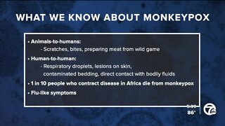 Dr. Nandi breaks down what you need to know about rare monkeypox virus